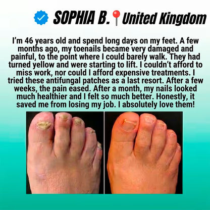 NailLab™ — Fungal Nail Patches